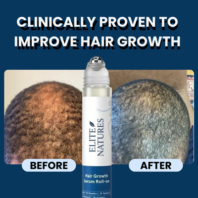 Hair Growth Roll-On Serum
