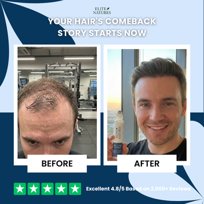 Hair Growth Roll-On Serum