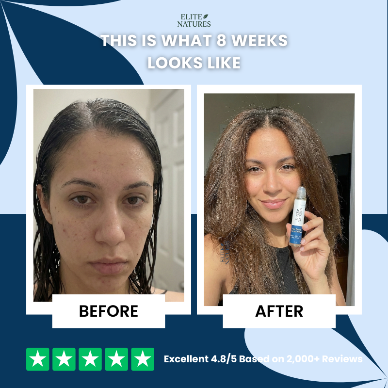 Hair Growth Roll-On Serum