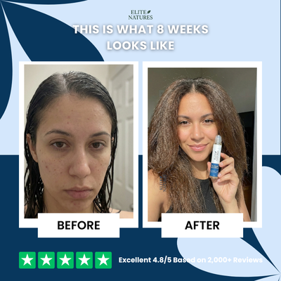 Hair Growth Roll-On Serum