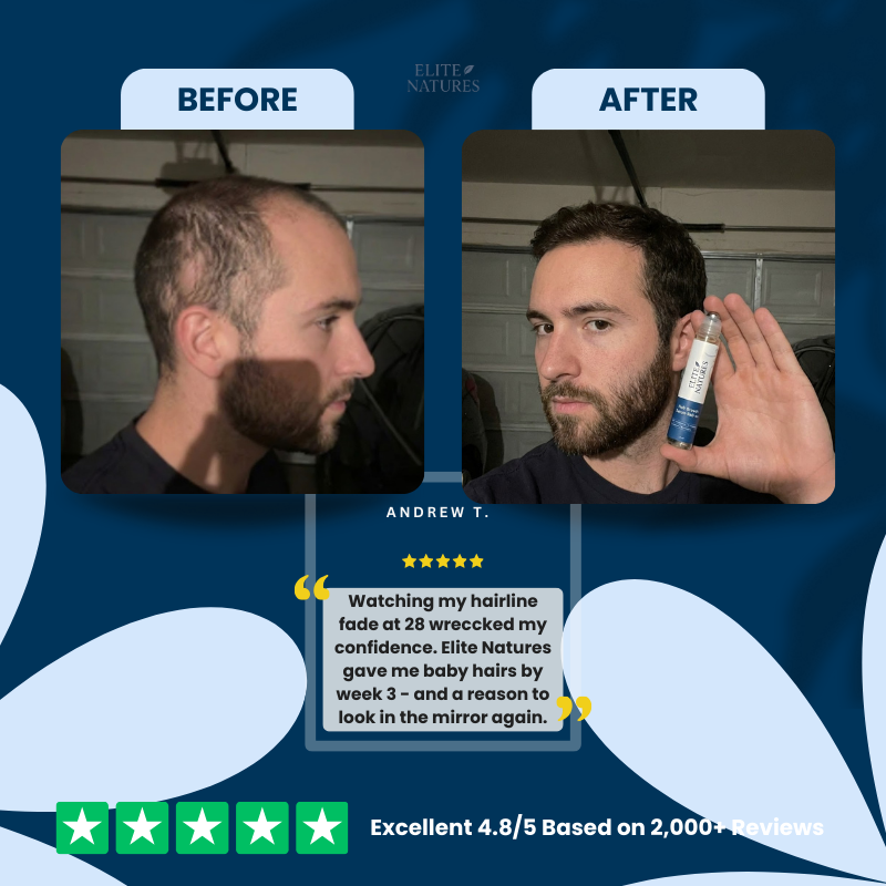 Hair Growth Roll-On Serum