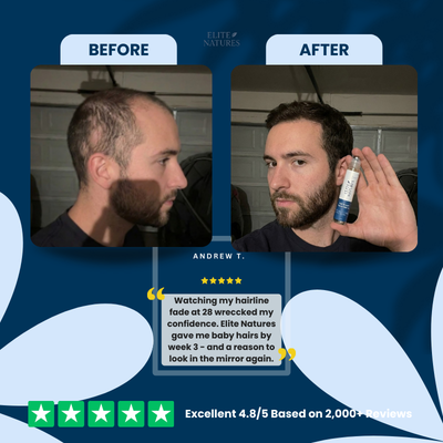 Hair Growth Roll-On Serum